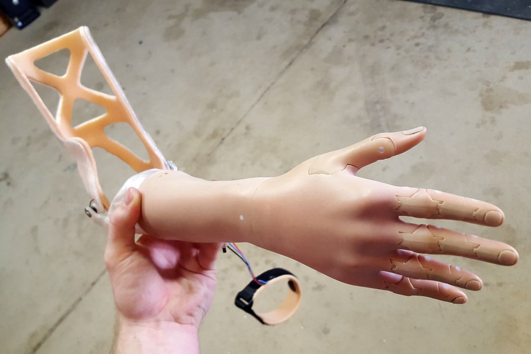 3D Printed Prosthetic arms