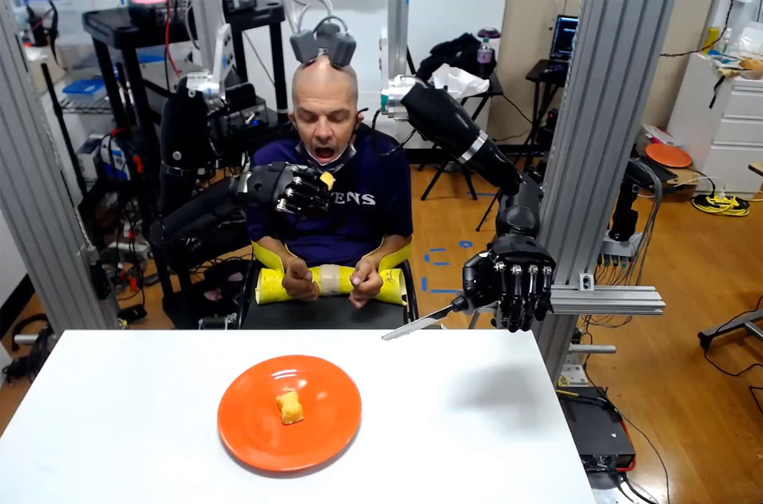 Quadriplegic patient uses brain signals to feed himself with two prosthetic arms.