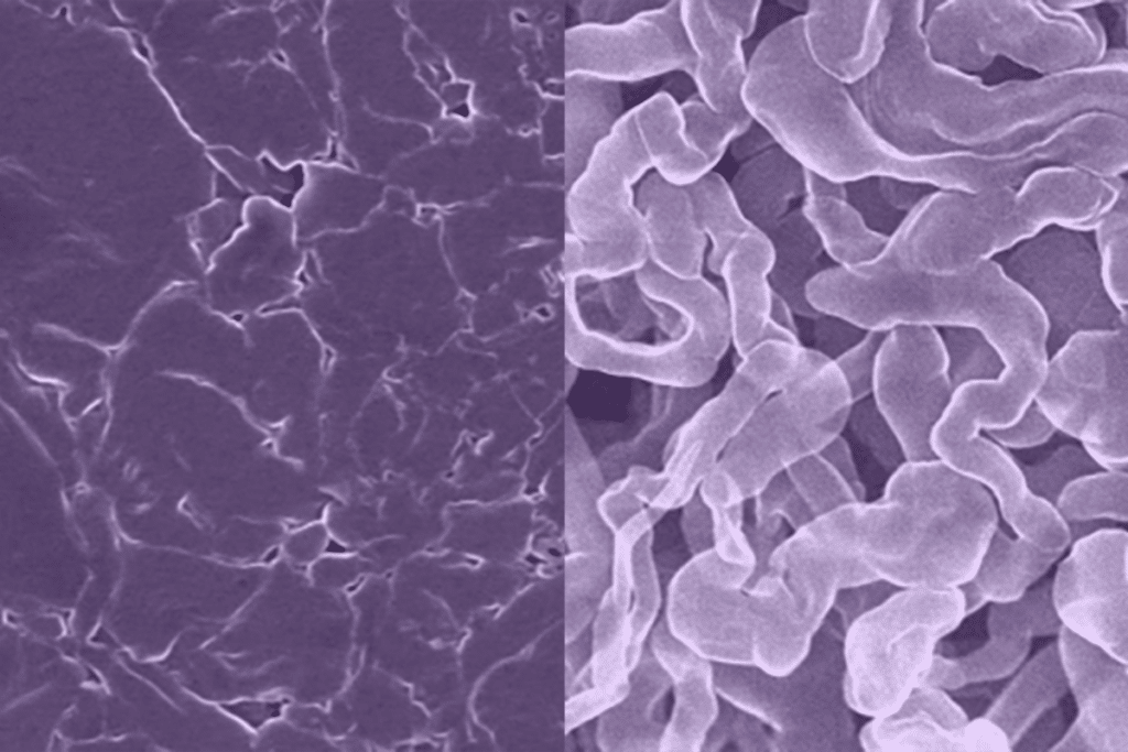 The new sodium metal anode for rechargeable batteries (left) that resists the formation of dendrites, a common problem with standard sodium metal anodes (right) that can lead to shorting and fires.