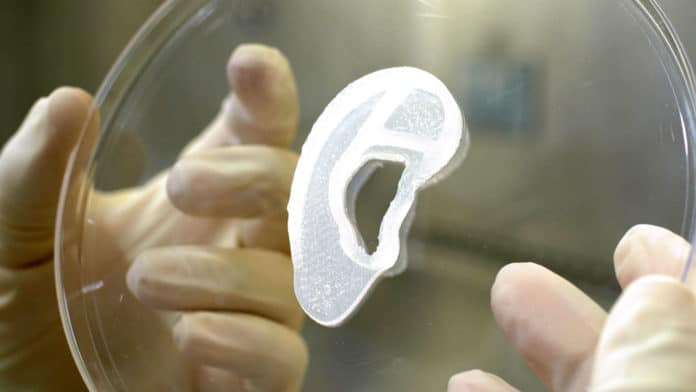 3DBio implants 3D-bioprinted ear in a first-in-human clinical trial.
