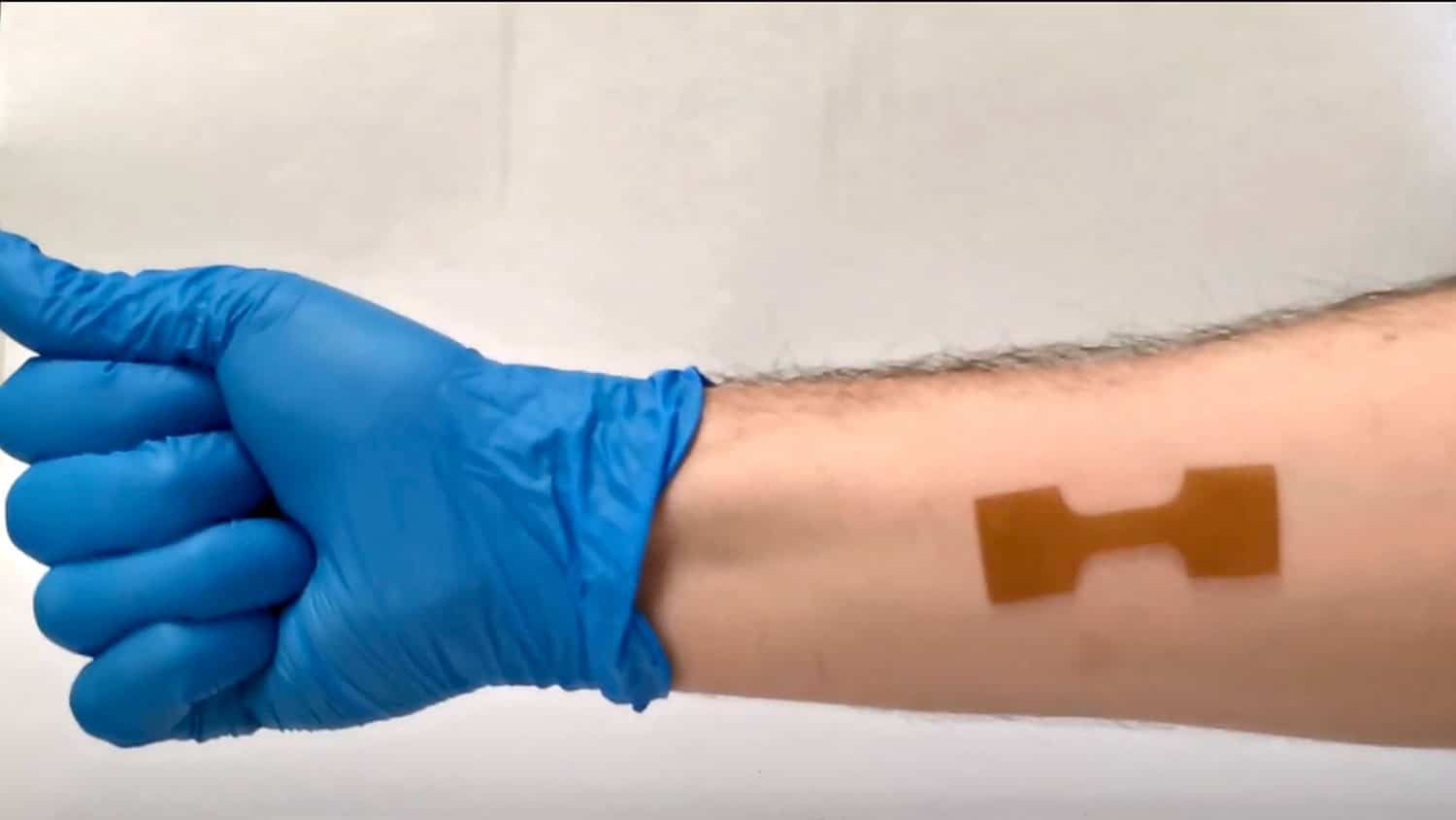 Researchers have developed intelligent hydrogel materials for use as a reusable wound dressing.