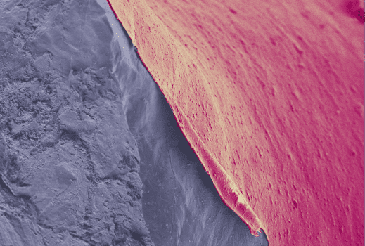 SEM image of nanoporous polymer-coated lithium.