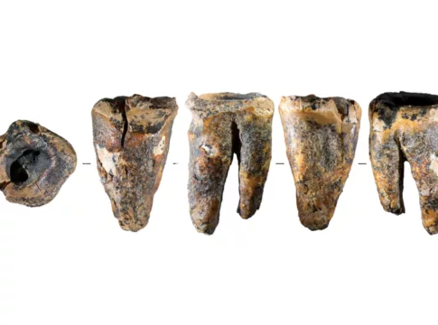chagyrskaya 64 molar tooth Chagyrskaya 64 molar tooth and its macro-features: General view of the tooth in five projections.